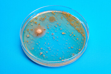 Petri dish with biological samples in a   laboratory of a medical clinic