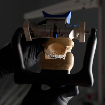 Dental technician or orthopedic dentist holding an articulator in the dental office. Dentist hands. The work of a technician in a dental laboratory. The concept of prosthetics and implantology.