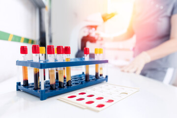 Closeup man worker use microscope in laboratory, analyzing blood test virus check