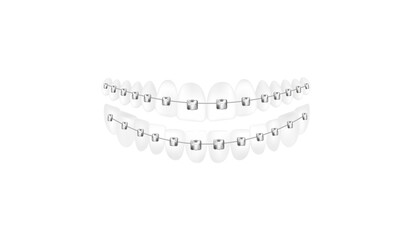 Obraz premium Lower and upper teeth with dental braces, realistic vector illustration isolated.