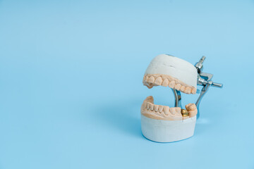 Study model of teeth and gums. On blue background. Dental concept
