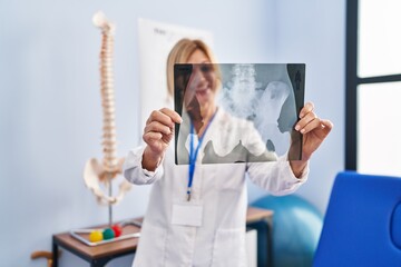 Middle age blonde woman wearing physiotherapist uniform holding xray at physiotherapy clinic