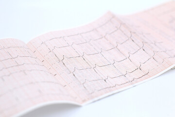 Medical cardiogram printed on paper on the table