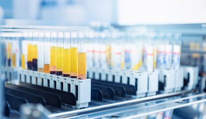 Test tubes with blood for automatic biochemical analyzer. Medical lab equipment biomedical banner...