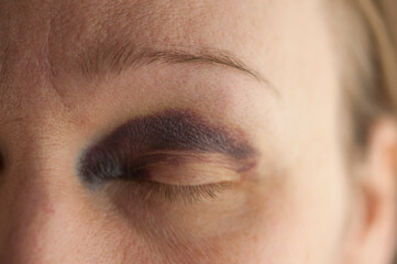 Sad beaten up girl with wounds on the face looking at the camera with deep look