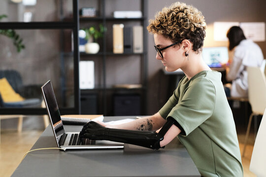 Young woman with prosthetic arm typing on laptop while sitting at office desk