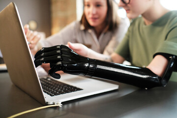 Close-up of woman with prosthesis arm pointing at monitor of laptop and discussing with her...