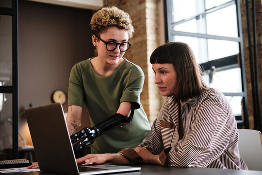 Young woman with prosthetic arm pointing at monitor of laptop and discussing online presentation with her colleague at office