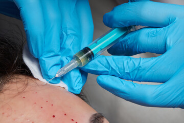 Injection at spa salon. Doctor hands in gloves. Closeup. Pretty male patient. Beauty treatment....