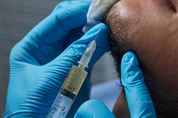 Injection plasma into beard hair man cosmetologist doctor.