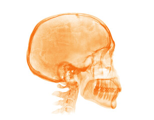 Human skull. Orange X-ray image on white background