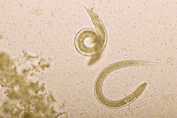 Strongyloides stercoralis or threadworm in human stool, analyze by microscope, original magnification 400x