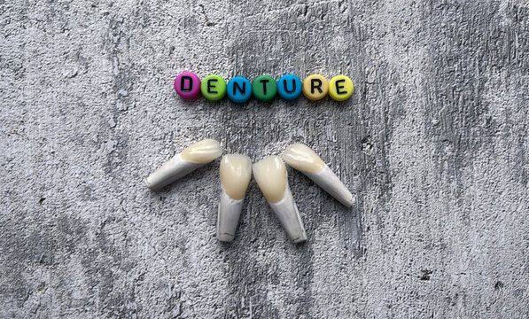 Manufacture of winners and crowns in the dental laboratory. Disassembled model made of refractory gypsum according to Geller. The word "denture" made of multicolored letters