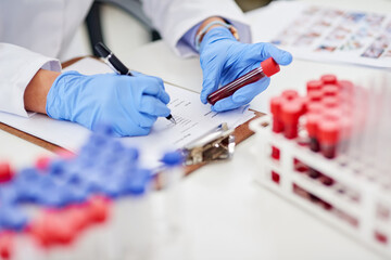 Compiling a detailed report of the latest findings. Closeup shot of a scientist examining a blood sample and recording findings in a lab.