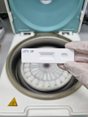 A rapid Kit for detection of IgM against Leptospira in human. Hand of a scientist holding a Leptospira antibody test kit . negative test result.
