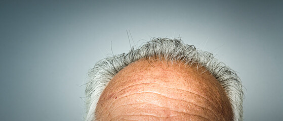 bald person closeup