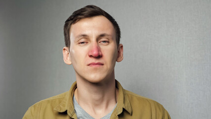 Sick man with red nose standing on grey background, closeup. Young male suffers from allergy to dust
