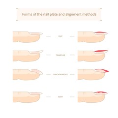 Forms of the nail plate and alignment methods. Nail shapes. Vector stock illustration - obrazy, fototapety, plakaty