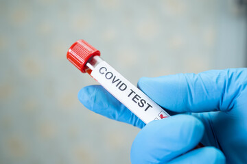 Obraz premium Positive blood infection sample in test tube for covid-19 coronavirus in lab. Scientist holding to check and analyze for patient in hospital.