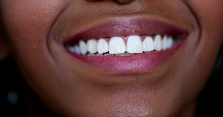 Black girl mouth smiling macro close-up white teeth, african ethnicity