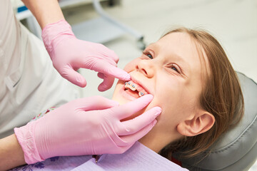 Braces for child teeth correction. Installation and maintenace - obrazy, fototapety, plakaty