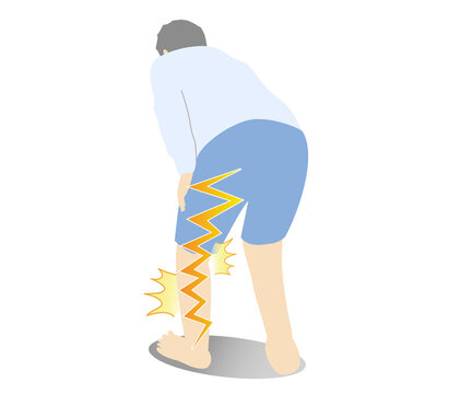Illustration of a person suffering from sciatica