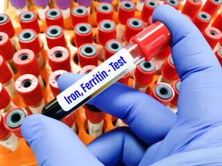 Blood sample for Iron, TIBC and Ferritin level test. To diagnosis Iron deficiency anemia at medical...