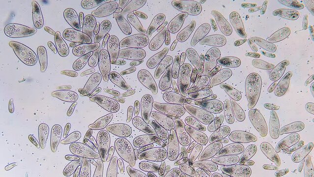 High density of unicellular paramecium  protozoa under microscope