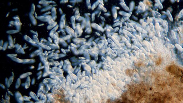High density of unicellular paramecium  protozoa under microscope