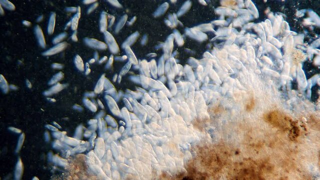 High density of unicellular paramecium  protozoa under microscope