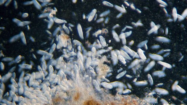 High density of unicellular paramecium  protozoa under microscope