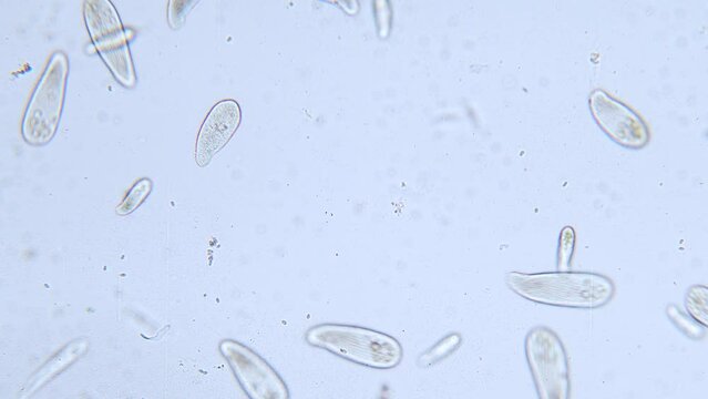 High density of unicellular paramecium  protozoa under microscope