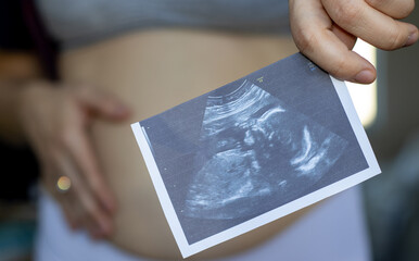 pregnant woman is holding ultrasound picture in one hand and on the belly another hand. pregnancy...