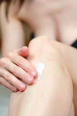 Open jar of cream in a female hand. Acne cream. Irritation after depilation.