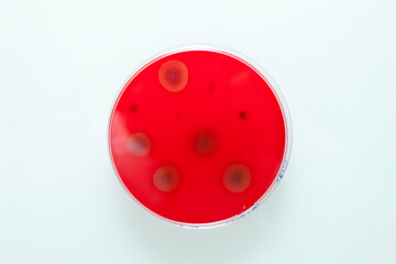 culture de germes en laboratoire 