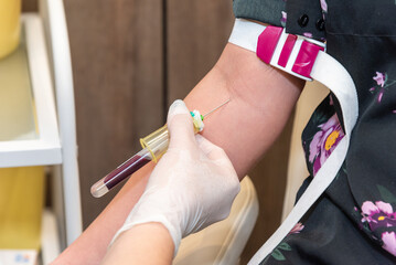 Blood sampling from a patient's vein in the laboratory. Blood test and blood donation at hospital