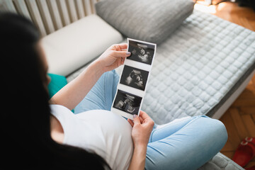A black-haired caucasian pregnant female looks at ultrasound baby pictures. She holds ultrasound paper in front of her pregnant belly. A woman sits on the bed with crossed legs in the sitting room.