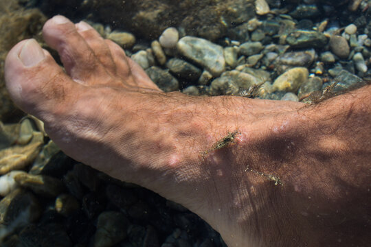 Shrimps on the leg