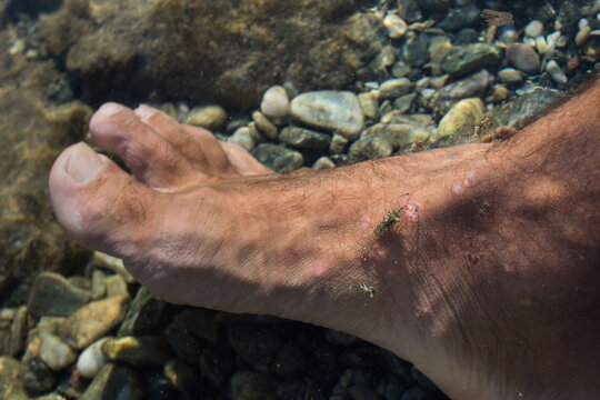 Shrimp and wounds
