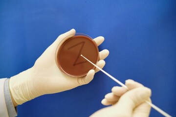 Scientists are holding and  Z-Line on Culture plate, Blood agar, Chocolate agar, MacConkey agar, ...