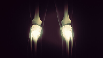  Medical concept of pain in the knee joint