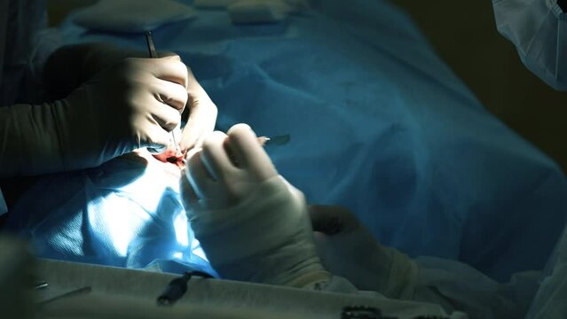 Surgery. Surgeon's hands and scissors. The concept of surgical treatment with an assistant. Medical hands using surgical instruments