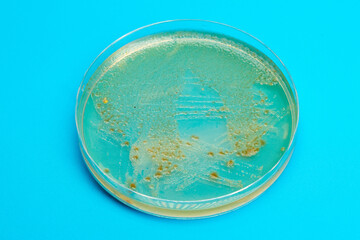 Petri dish with biological samples in a   laboratory of a medical clinic
