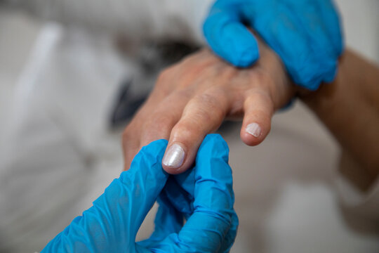 Doctor examining patient's hand. rheumatoid arthritis and doctor in images, rheumatoid arthritis and doctor