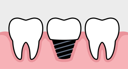 Tooth icons set. Human tooth. Symbol of doctor dentist and treatment. Isolated raster illustration on white background.