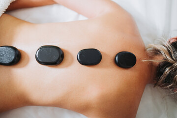 Obraz na płótnie Canvas Hot spa volcanic lava stone placed on a female patient's back, by a physiotherapist. Energy stones.
