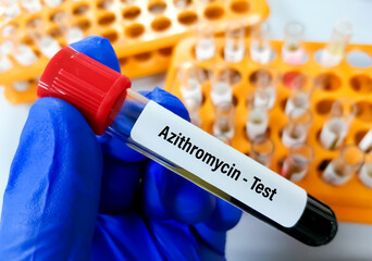 Blood sample on scientist hand for Azithromycin test, to set therapeutic range of Azithromycin.