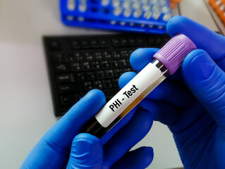 Blood sample tube with sample for PHI (Prostate Health Index) test for prostate cancer. A combination test of Prostate specific antigen including total PSA, free PSA and p2PSA.