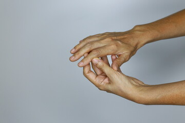close-up woman hand of rheumatoid patient