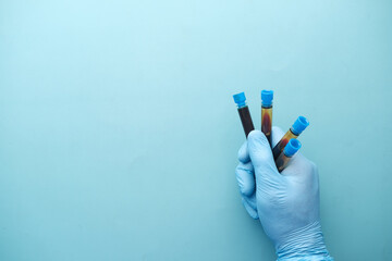 hand in blue medical gloves holding blood test tube 